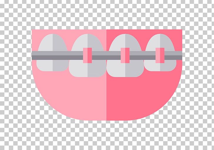 Mouth Pediatric Dentistry Tooth Cosmetic Dentistry PNG, Clipart, Angle, Computer Icons, Cosmetic Dentistry, Dental Braces, Dental Implant Free PNG Download