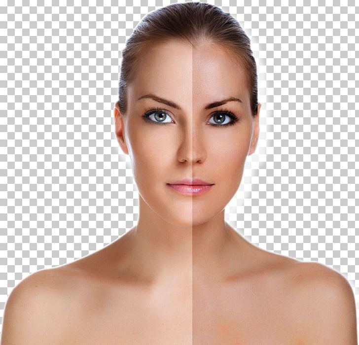 Stock Photography Face Rhytidectomy Skin PNG, Clipart, Adult Woman, Beauty, Cheek, Chin, Clean Skin Free PNG Download