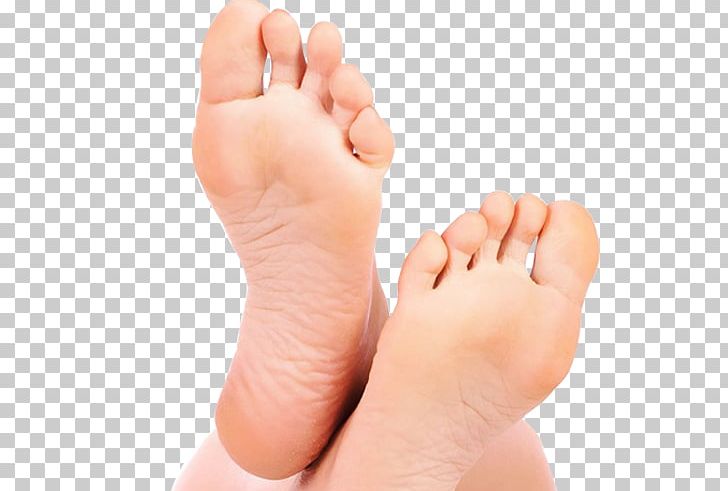 Foot Podiatry Infant Flat Feet Podiatrist PNG, Clipart, Ankle, Callus, Child, Corn, Diabetic Foot Free PNG Download