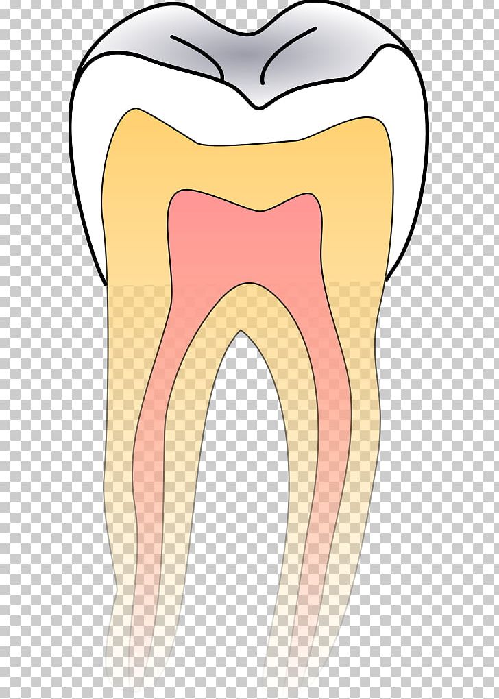 Dentistry Tooth Decay PNG, Clipart, Cheek, Cosmetic Dentistry, Dental Calculus, Dental Implant, Dental Restoration Free PNG Download