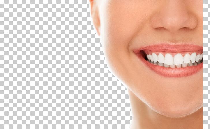Dentistry Oral Hygiene Dental Implant Dental Public Health PNG, Clipart, Cheek, Closeup, Cosmetic Dentistry, Dental Braces, Dental Floss Free PNG Download