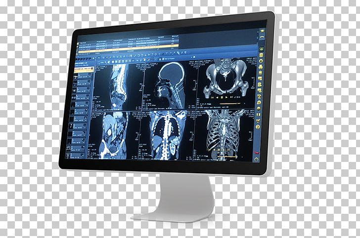 Archiving And Communication System DICOM Medical Imaging Physician Hospital PNG, Clipart, Computer Monitor, Computer Monitor Accessory, Computer Software, Display Advertising, Display Device Free PNG Download