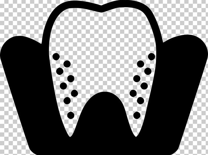 Dentistry Medicine Tooth Whitening PNG, Clipart, Black, Black And White, Caries, Dentist, Dentistry Free PNG Download