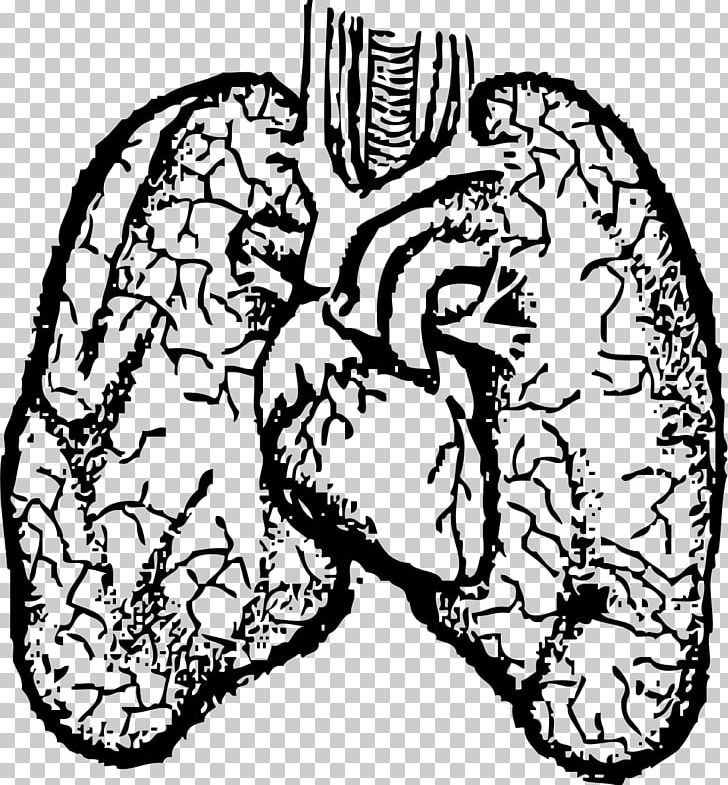 Heartu2013lung Transplant Heartu2013lung Transplant Human Body PNG, Clipart, Anatomy, Area, Art, Black And White, Brain Free PNG Download