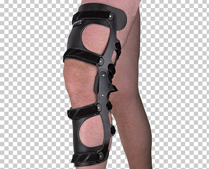 Knee Pain Orthotics Foot Genu Varum PNG, Clipart, Crus, Disease, Extension, Femur, Foot Free PNG Download