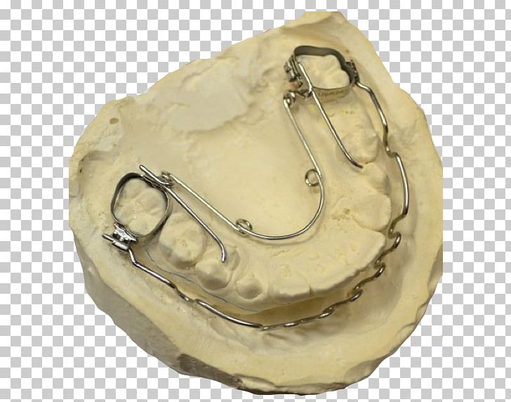 Quad Helix Orthodontics Jaw Moscow Orthodontic Laboratory PNG, Clipart, Article, Beige, Helix, Instagram, Jaw Free PNG Download