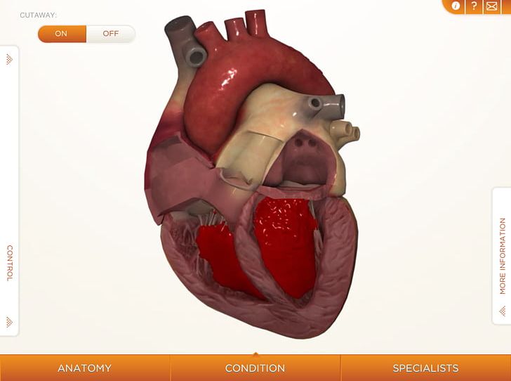 Heart Cardiovascular Disease Human Body Anatomy Muscle PNG, Clipart, Anatomy, Artery, Blood Vessel, Cardiac Muscle, Cardiovascular Disease Free PNG Download