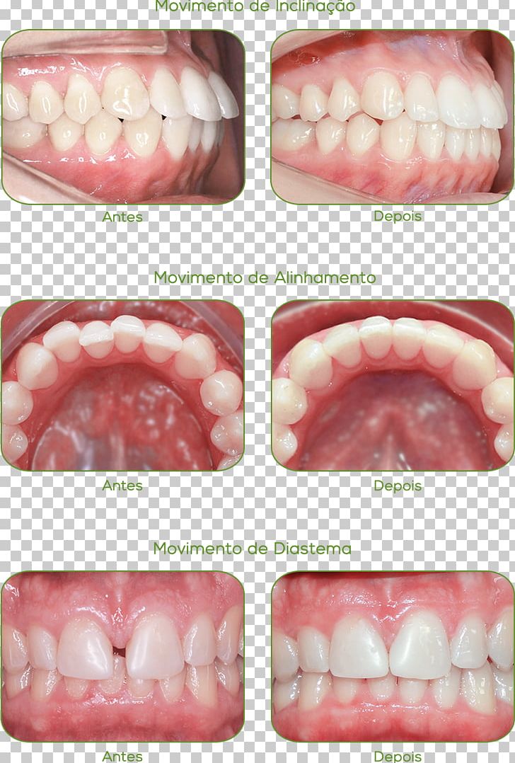 Case Report Jaw Orthodontics Health Acetate PNG, Clipart, Acetate, Beauty, Case Report, Clinic, Dentistry Free PNG Download