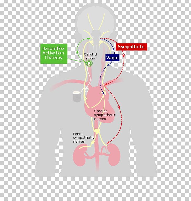 Baroreflex Baroreceptor Heart Carotid Sinus Parasympathetic Nervous System PNG, Clipart, Activation, Autonomic Nervous System, Baroreceptor, Baroreflex, Blood Pressure Free PNG Download