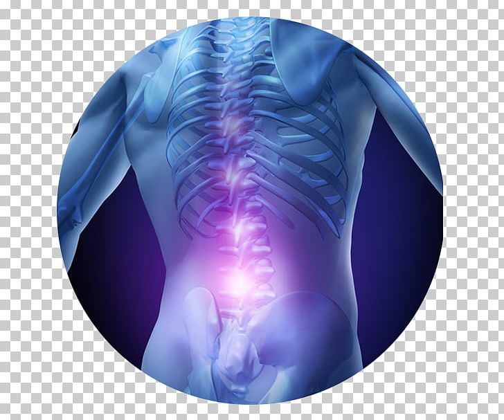 Low Back Pain Pain Management Therapy Spinal Disc Herniation PNG, Clipart, Back Pain, Human Back, Intervertebral Disc, Jaw, Joint Free PNG Download