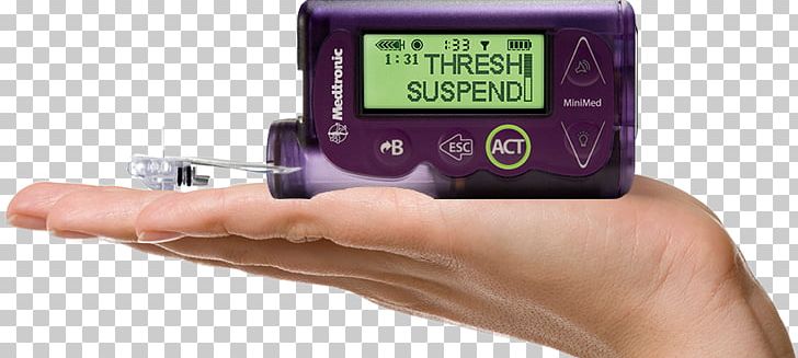 Insulin Pump Diabetes Mellitus Minimed Paradigm Type 1 Diabetes PNG, Clipart, Artificial Pancreas, Blood Glucose Meter, Blood Glucose Monitoring, Continuous Glucose Monitor, Diabetes Mellitus Free PNG Download