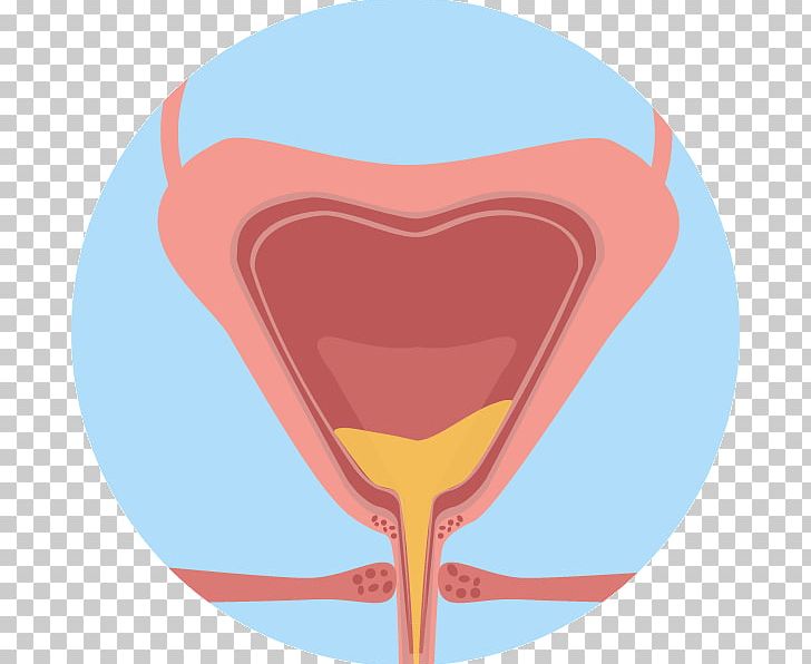 Urinary Bladder Overactive Bladder Urinary Tract Infection Kidney PNG, Clipart, Cartoon, Clip Art, Excretory System, Health, Heart Free PNG Download