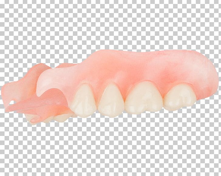 Tooth Dentures Peach PNG, Clipart, Aspen, Aspen Dental, Dental, Dentures, Flexible Free PNG Download