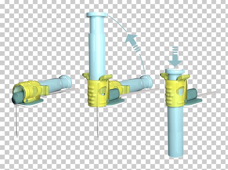 Cardiomed Supplies Inc Hypodermic Needle Catheter Needlestick Injury Patient PNG, Clipart, Blood, Cardiomed Supplies Inc, Catheter, Cylinder, Dialysis Free PNG Download