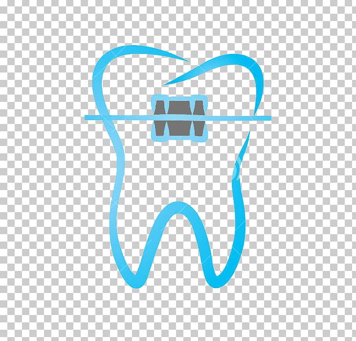 ORTHODONTICS: THE ART AND SCIENCE Dental Braces Tooth PNG, Clipart, Aqua, Braces, Dental Braces, Dental Radiography, Dentistry Free PNG Download