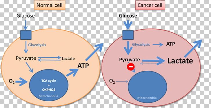 Warburg Effect Cancer Warburg Hypothesis Glycolysis Metabolism PNG, Clipart, Angle, Cancer, Cancer Cell, Carcinogen, Carcinoma Free PNG Download