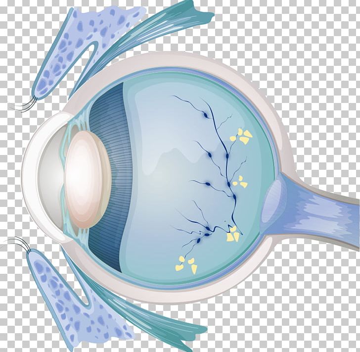 Optician Eye Examination Diabetic Retinopathy Visual Perception PNG, Clipart, Deobenti, Diabetic Retinopathy, Disease, Education, Epicanthic Fold Free PNG Download