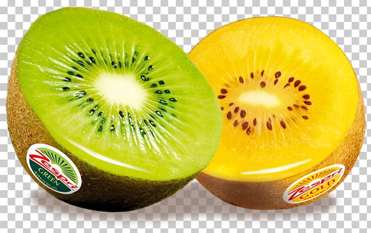 Kiwifruit Auglis Actinidia Deliciosa Passion Fruit PNG, Clipart, Actinidia Deliciosa, Auglis, Barbados Cherry, Blueberry, Citrus Free PNG Download