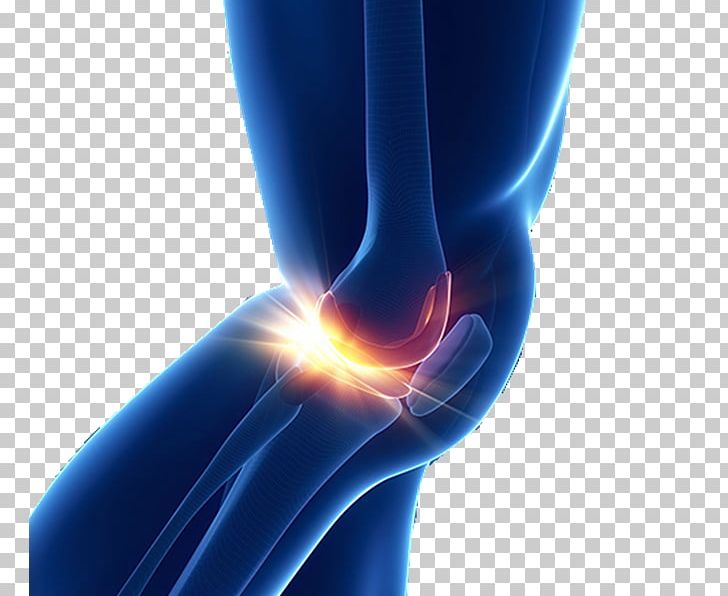 Knee Replacement Medicine Joint Therapy PNG, Clipart, Arm, Closeup, Computer Wallpaper, Dynamic Physiotherapy, Elbow Free PNG Download