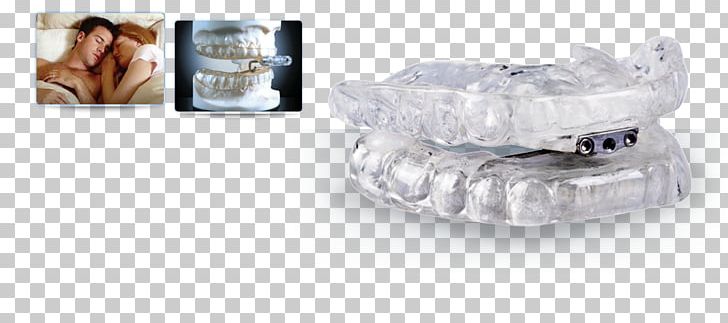 Snoring Dentistry Mandibular Advancement Splint Mouthguard PNG, Clipart, Apnea, Body Jewelry, Cosmetic Dentistry, Dental Laboratory, Dental Restoration Free PNG Download