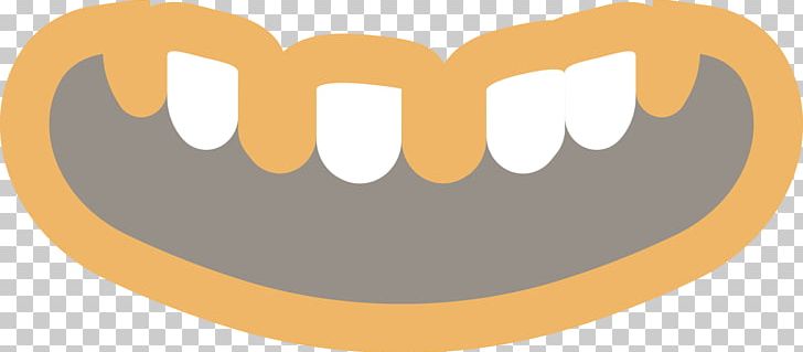 Tooth Dentistry Bridge Crown Dentures PNG, Clipart, Be Used To, Bridge, Crown, Dental Implant, Dentistry Free PNG Download