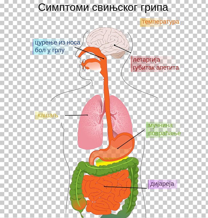 Swine Influenza Symptom Disease Influenza Pandemic PNG, Clipart, Area, Disease, Fever, Headache, Human Behavior Free PNG Download