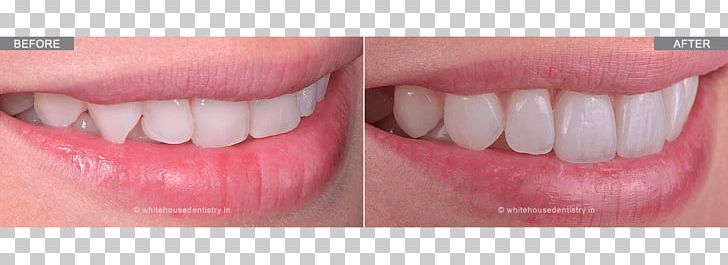 Smile Human Tooth Dentist White House Tooth Whitening PNG, Clipart, Chin, Cosmetic Dentistry, Dentist, Engineer, Health Free PNG Download