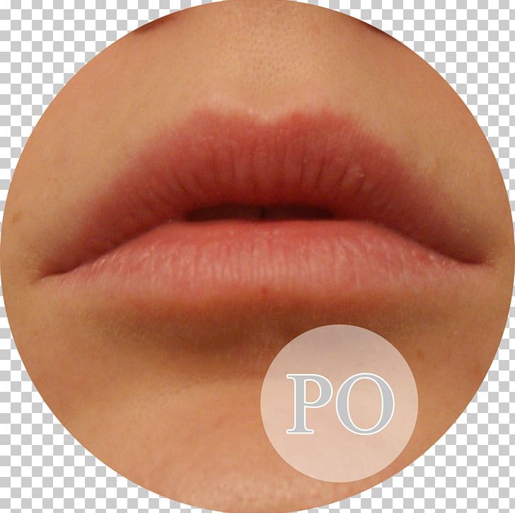 Lip Gloss Lipstick Eyelash Peach PNG, Clipart, Cheek, Chin, Closeup, Cosmetics, Dxd Free PNG Download