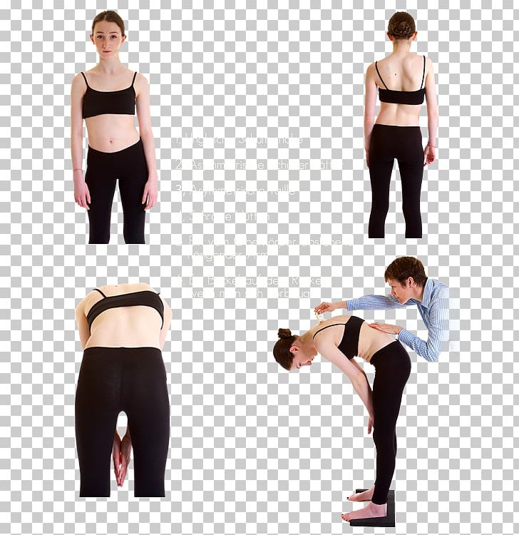 Scoliosis Medical Diagnosis Vertebral Column Therapy Child PNG, Clipart, Abdomen, Active Undergarment, Arm, Asento, German Spitz Mittel Free PNG Download