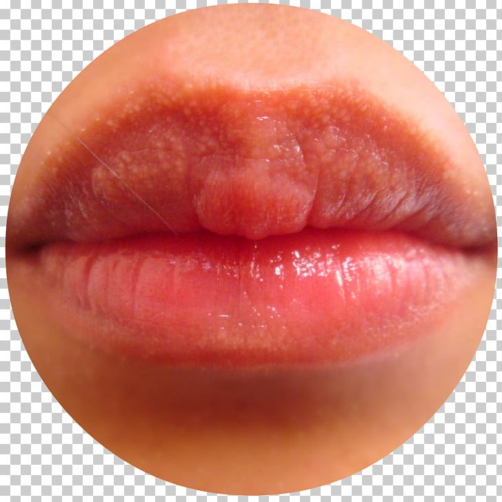 Lip Balm Mouth Lipstick Lip Gloss PNG, Clipart, Closeup, Color, Cosmetics, Dyschromia, Exfoliation Free PNG Download