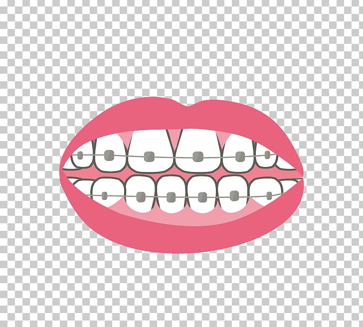 Human Tooth PNG, Clipart, Human Tooth, Jaw, Lip, Mouth, Organ Free PNG Download