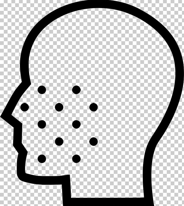 Acne Computer Icons Medicine Skin Care PNG, Clipart, Acne, Black, Black And White, Computer Icons, Dermatoloji Free PNG Download