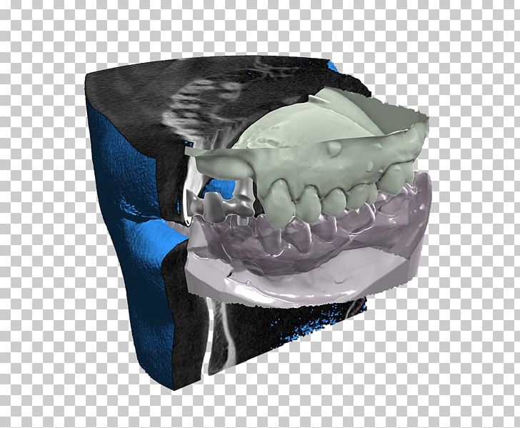CAD/CAM Dentistry DICOM Computer Software Abutment Computer-aided Design PNG, Clipart, Abutment, Basis, Cadcam Dentistry, Cadstar, Computed Tomography Free PNG Download