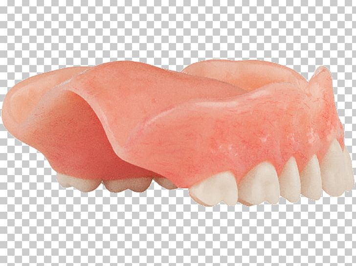 Dentures Human Tooth PNG, Clipart, Dentures, Human Tooth, Jaw, Mouth, Peach Free PNG Download