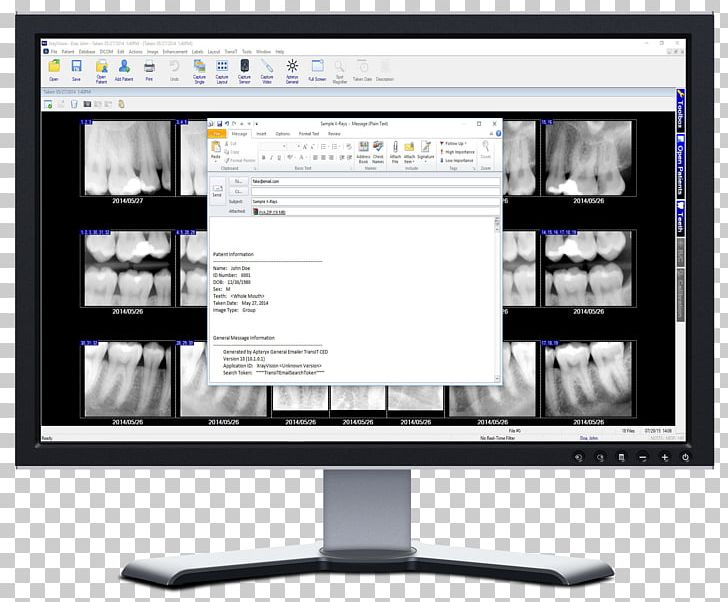 X-ray Vision Computer Monitors Computer Software Display Device Dental Radiography PNG, Clipart, Apteryx Inc, Communication, Computer Monitor, Computer Monitor Accessory, Den Free PNG Download