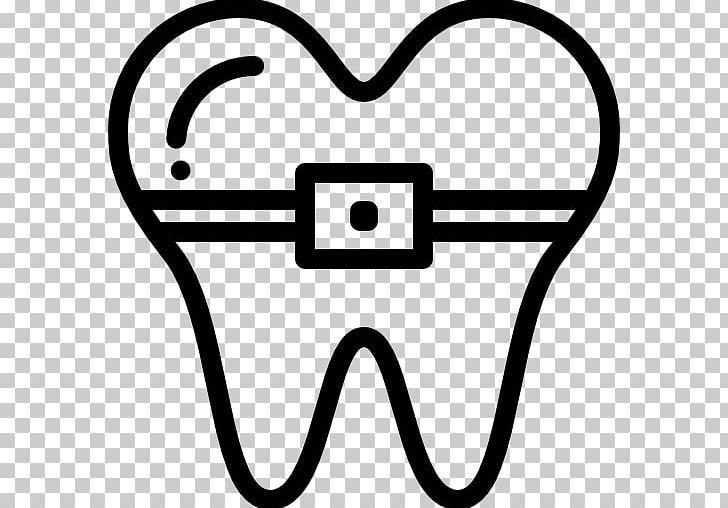 Cosmetic Dentistry Dental Braces Tooth PNG, Clipart, Angle, Black And White, Cosmetic Dentistry, Dental Braces, Dental Implant Free PNG Download