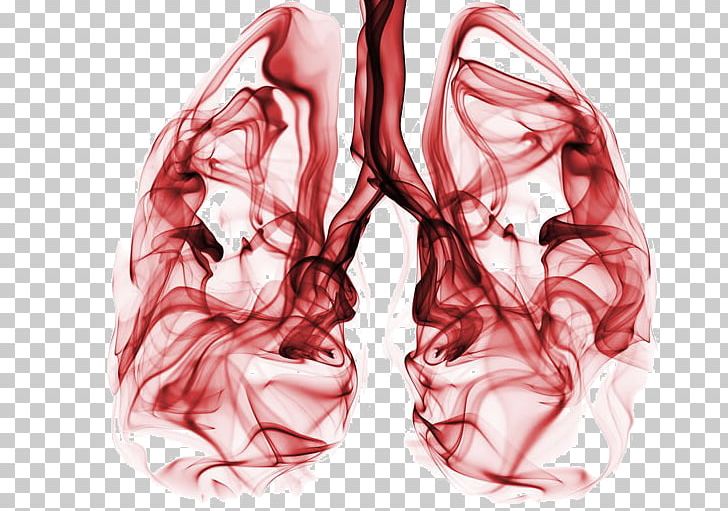 Non-small Cell Lung Cancer Small-cell Carcinoma PNG, Clipart, Arm, Cancer, Chemotherapy, Disease, Flesh Free PNG Download