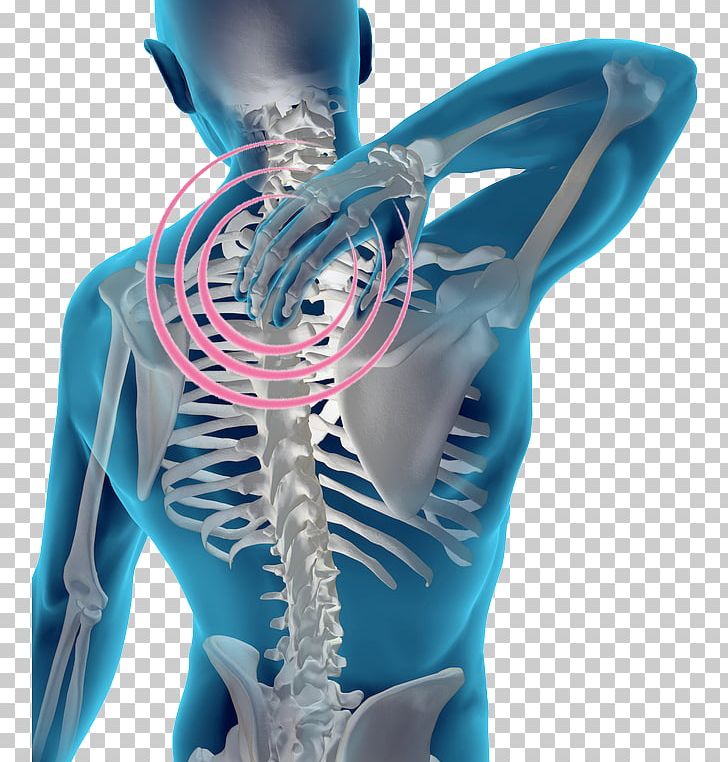 Pain In Spine Vertebral Column Human Back Cervical Vertebrae Facet Joint PNG, Clipart, Arm, Back, Cervical Vertebrae, Chiropractic, Chiropractor Free PNG Download