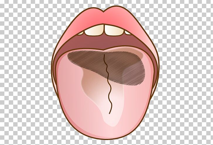 歯科 Dentist Tongue Mouth Bad Breath PNG, Clipart, Bad Breath, Cheek, Dentist, Eye, Face Free PNG Download