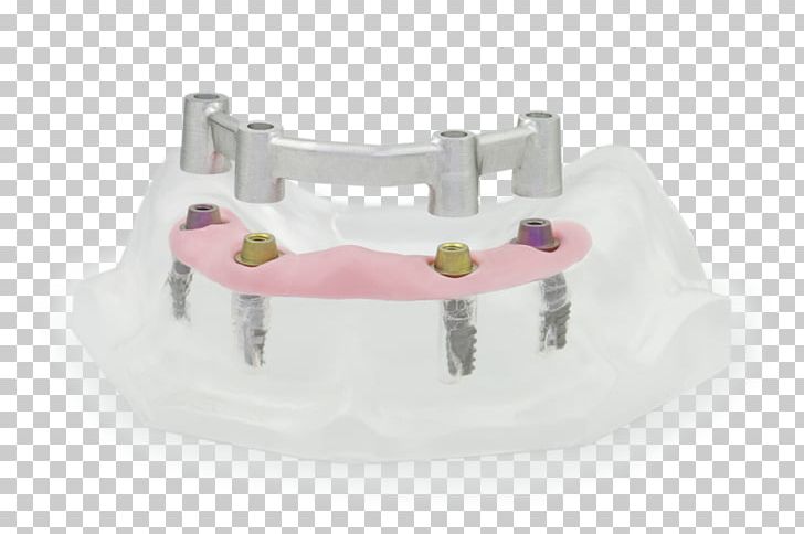 CAD/CAM Dentistry Computer-aided Design Computer-aided Manufacturing PNG, Clipart, Abutment, Art, Cadcam Dentistry, Computeraided Design, Computeraided Manufacturing Free PNG Download