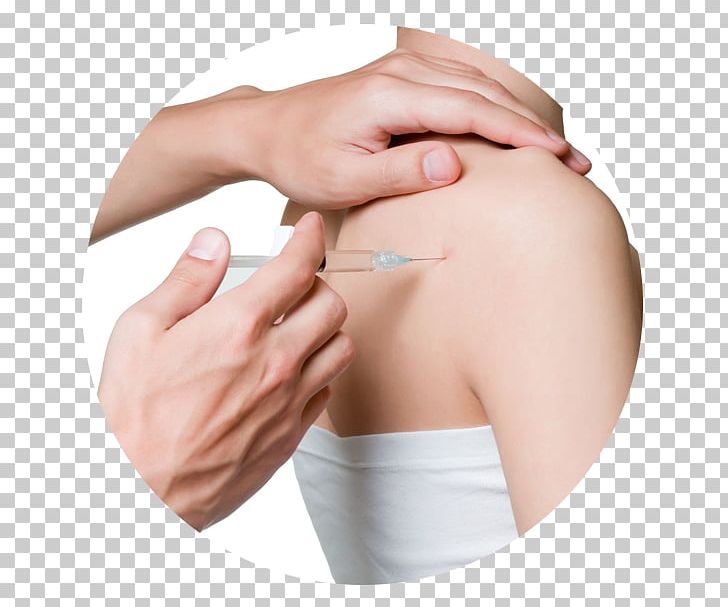 Myofascial Trigger Point Joint Injection Therapy Medicine PNG, Clipart, Abdomen, Ache, Arm, Bursitis, Cheek Free PNG Download