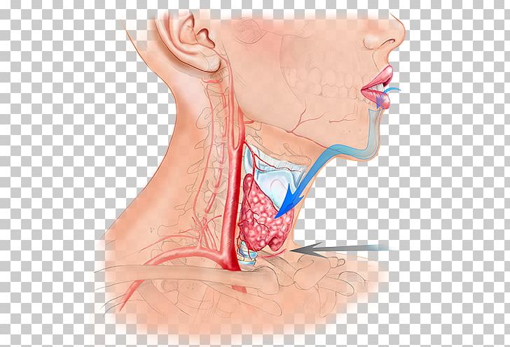 Ear Surgery Thyroidectomy Endoscopy Laparoscopy PNG, Clipart, Abdomen, Arm, Face, Hand, Head Free PNG Download