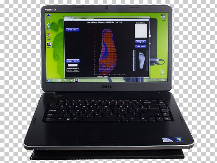 Computer Hardware Scanner Netbook Personal Computer Orthotics PNG, Clipart, Computer, Computer Accessory, Computer Hardware, Computer Lab, Computer Monitors Free PNG Download