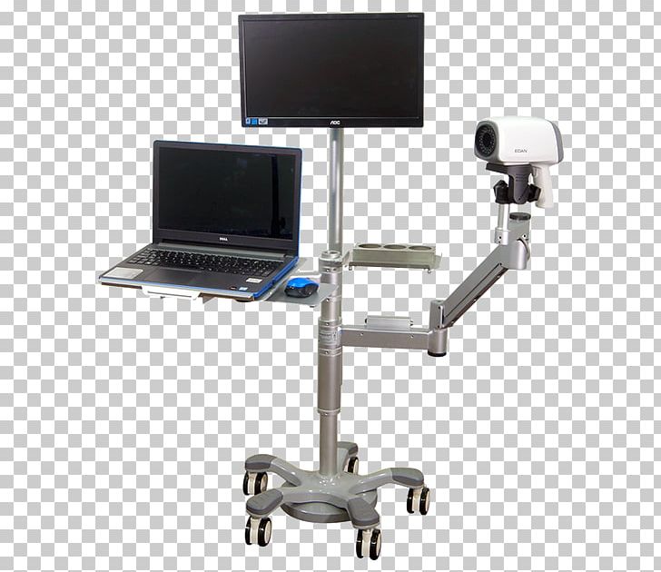 Idisac Culpascope Computer Monitor Accessory Cervix Medical Diagnosis PNG, Clipart, Angle, Cervix, Computer Monitor Accessory, Dashiel Edan Anderson, Desk Free PNG Download