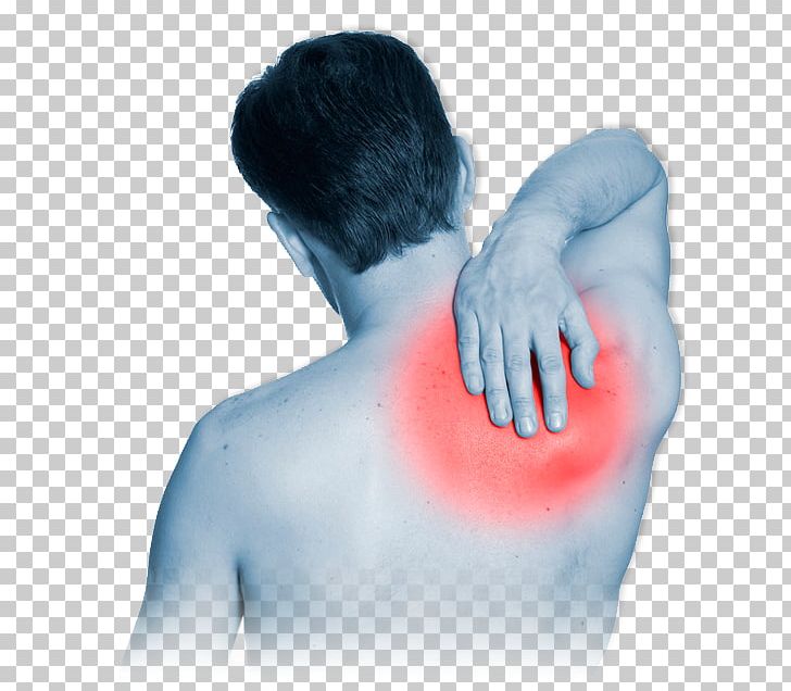 Back Pain Nape Neck Pain Therapy Shoulder Pain PNG, Clipart, Abdomen, Ache, Arm, Arm Muscle, Back Free PNG Download