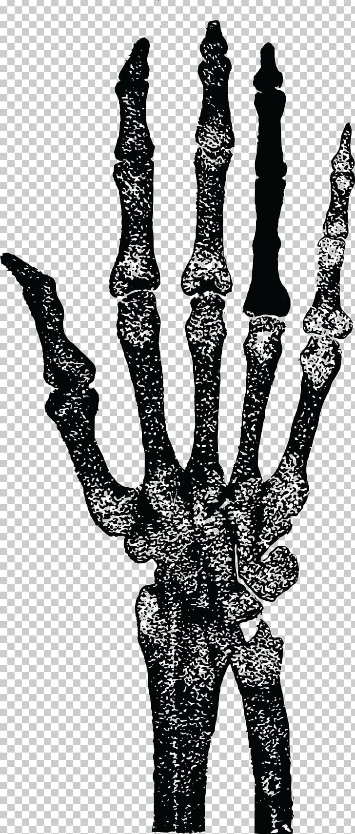 Human Skeleton Finger Hand Human Anatomy PNG, Clipart, Anatomy, Black And White, Bone, Elbow, Fantasy Free PNG Download