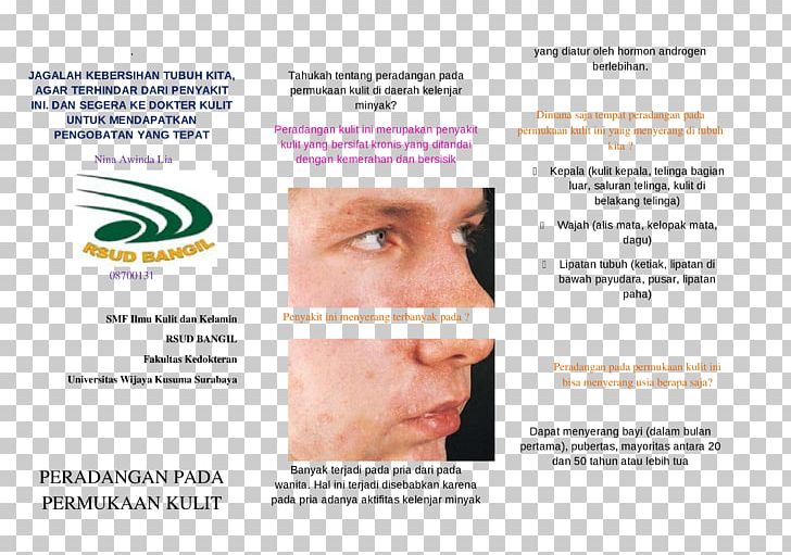 Advertising Brochure Brand Font PNG, Clipart, Advertising, Brand, Brochure, Chin, Dermatitis Free PNG Download
