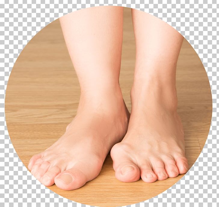 Bunion Podiatry Foot Toe Plantar Fasciitis PNG, Clipart, Ankle, Bunion, Diseases Of The Foot, Flat Feet, Foot Free PNG Download
