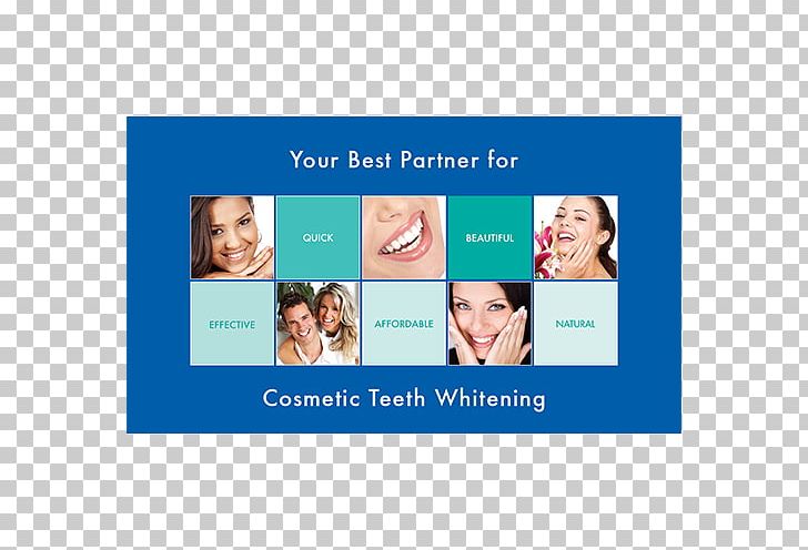 Tooth Whitening Business Cards Dentistry Human Tooth PNG, Clipart, Advertising, Banner, Brand, Business, Business Cards Free PNG Download