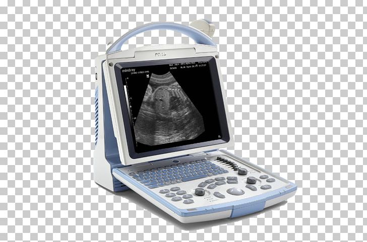 Ultrasonography Mindray Ultrasound Medicine Doppler Echocardiography PNG, Clipart, Electronic Device, Fda, Health, Health Care, Medical Diagnosis Free PNG Download